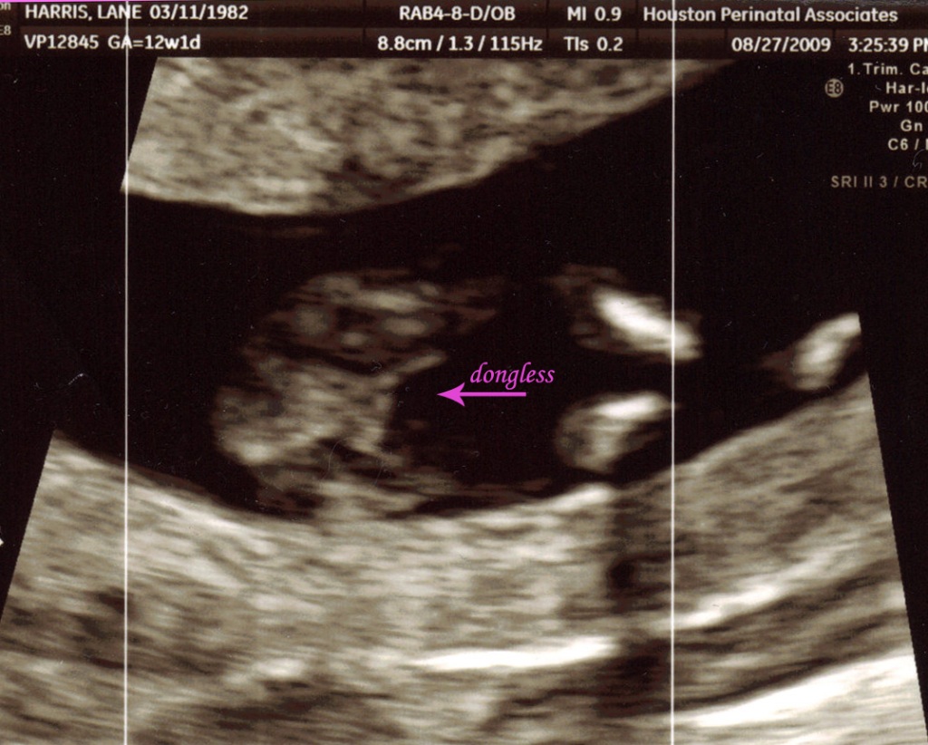 baby #2 gender ultrasound copy